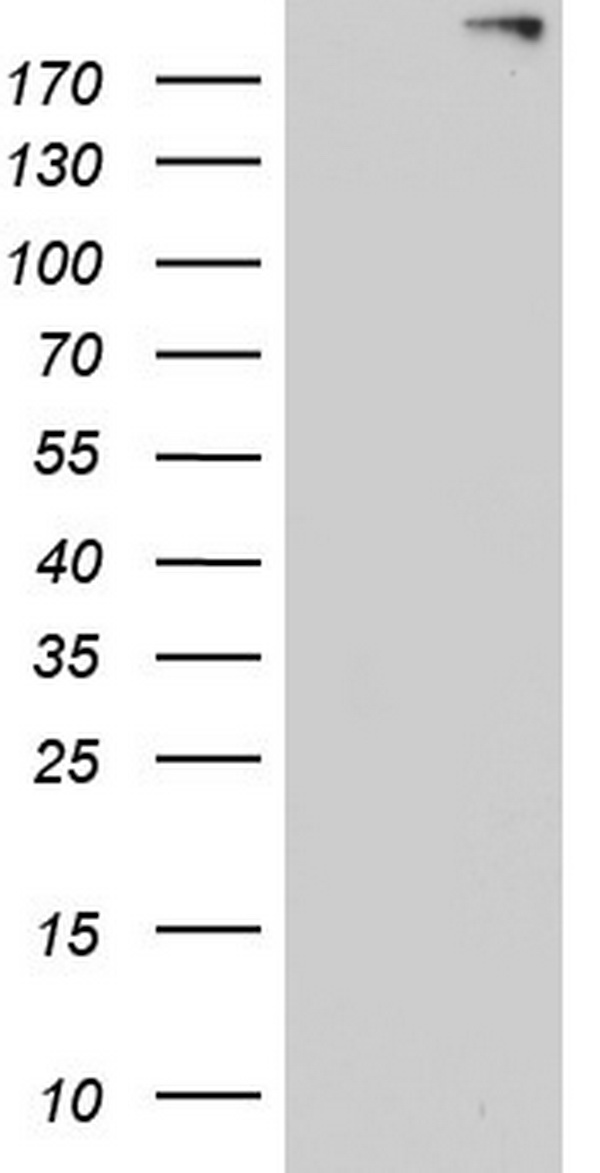 ANO1 / DOG1 / TMEM16A Antibody - HEK293T cells were transfected with the pCMV6-ENTRY control (Left lane) or pCMV6-ENTRY ANO1 (Right lane) cDNA for 48 hrs and lysed. Equivalent amounts of cell lysates (5 ug per lane) were separated by SDS-PAGE and immunoblotted with anti-ANO1.