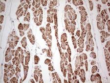 ANO1 / DOG1 / TMEM16A Antibody - IHC of paraffin-embedded Human adult heart tissue using anti-ANO1 mouse monoclonal antibody. (Heat-induced epitope retrieval by 1 mM EDTA in 10mM Tris, pH8.5, 120°C for 3min).
