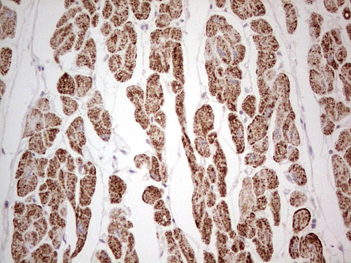 ANO1 / DOG1 / TMEM16A Antibody - IHC of paraffin-embedded Human adult heart tissue using anti-ANO1 mouse monoclonal antibody. (Heat-induced epitope retrieval by 1 mM EDTA in 10mM Tris, pH8.5, 120°C for 3min).