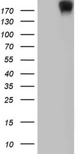 ANO1 / DOG1 / TMEM16A Antibody - HEK293T cells were transfected with the pCMV6-ENTRY control (Left lane) or pCMV6-ENTRY ANO1 (Right lane) cDNA for 48 hrs and lysed. Equivalent amounts of cell lysates (5 ug per lane) were separated by SDS-PAGE and immunoblotted with anti-ANO1.