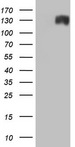 ANO1 / DOG1 / TMEM16A Antibody - HEK293T cells were transfected with the pCMV6-ENTRY control (Left lane) or pCMV6-ENTRY ANO1 (Right lane) cDNA for 48 hrs and lysed. Equivalent amounts of cell lysates (5 ug per lane) were separated by SDS-PAGE and immunoblotted with anti-ANO1.
