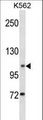 ANO1 / DOG1 / TMEM16A Antibody - ANO1 Antibody western blot of K562 cell line lysates (35 ug/lane). The ANO1 Antibody detected the ANO1 protein (arrow).