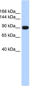 ANO1 / DOG1 / TMEM16A Antibody - Western blot of fetal muscle lysate.  This image was taken for the unconjugated form of this product. Other forms have not been tested.