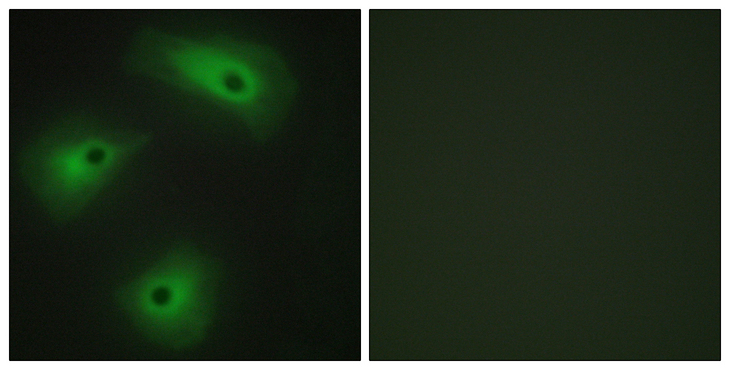 ANO1 / DOG1 / TMEM16A Antibody - Immunofluorescence analysis of HeLa cells, using TM16A Antibody. The picture on the right is blocked with the synthesized peptide.