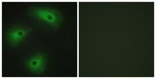 ANO1 / DOG1 / TMEM16A Antibody - Immunofluorescence analysis of HeLa cells, using TM16A Antibody. The picture on the right is blocked with the synthesized peptide.