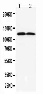 ANO1 / DOG1 / TMEM16A Antibody - WB of ANO1 / DOG1 / TMEM16A antibody. All lanes: Anti-ANO1 at 0.5ug/ml. Lane 1: Rat Liver Tissue Lysate at 40ug. Lane 2: Rat Skeletal Muscle Tissue Lysate at 40ug. Predicted bind size: 114KD. Observed bind size: 114KD.