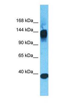 ANO1 / DOG1 / TMEM16A Antibody - Western blot of ANO1 Antibody with human THP-1 Whole Cell lysate.  This image was taken for the unconjugated form of this product. Other forms have not been tested.