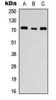 ANO1 / DOG1 / TMEM16A Antibody - Western blot analysis of ANO1 expression in HEK293T (A); H9C2 (B); HeLa (C) whole cell lysates.