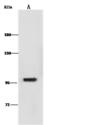 ANO1 / DOG1 / TMEM16A Antibody - Anti-ANO1 rabbit monoclonal antibody at 1:500 dilution. Lane A: A549 Whole Cell Lysate. Lysates/proteins at 30 ug per lane. Secondary: Goat Anti-Rabbit IgG (H+L)/HRP at 1/10000 dilution. Developed using the ECL technique. Performed under reducing conditions. Predicted band size: 114 kDa. Observed band size: 114 kDa.
