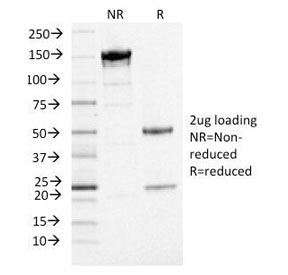 ANO1 / DOG1 / TMEM16A Antibody - SDS-PAGE Analysis of Purified, BSA-Free DOG 1 Antibody (clone DG1/1484). Confirmation of Integrity and Purity of the Antibody.