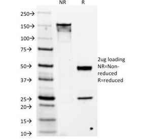 ANO1 / DOG1 / TMEM16A Antibody - SDS-PAGE Analysis of Purified, BSA-Free DOG1 Antibody (clone DG1/1486). Confirmation of Integrity and Purity of the Antibody.