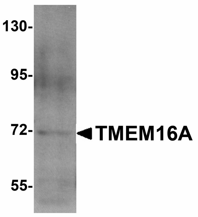 ANO1 / DOG1 / TMEM16A Antibody - Western blot of TMEM16A in A549 cell lysate with TMEM16A antibody at 1 ug/ml.
