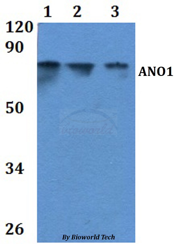 ANO1 / DOG1 / TMEM16A Antibody - Western blot of ANO1 antibody at 1:500 Line1:HEK293T whole cell lysate Line2:HeLa whole cell lysate Line3:H9C2 whole cell lysate Line4:.