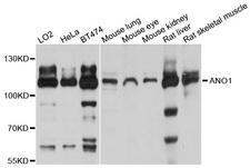 ANO1 / DOG1 / TMEM16A Antibody - Western blot analysis of extracts of various cell lines, using ANO1 antibody at 1:1000 dilution. The secondary antibody used was an HRP Goat Anti-Rabbit IgG (H+L) at 1:10000 dilution. Lysates were loaded 25ug per lane and 3% nonfat dry milk in TBST was used for blocking. An ECL Kit was used for detection and the exposure time was 5s.