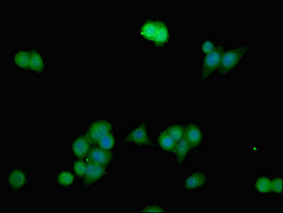 ANO1 / DOG1 / TMEM16A Antibody - Immunofluorescent analysis of PC3 cells at a dilution of 1:100 and Alexa Fluor 488-congugated AffiniPure Goat Anti-Rabbit IgG(H+L)