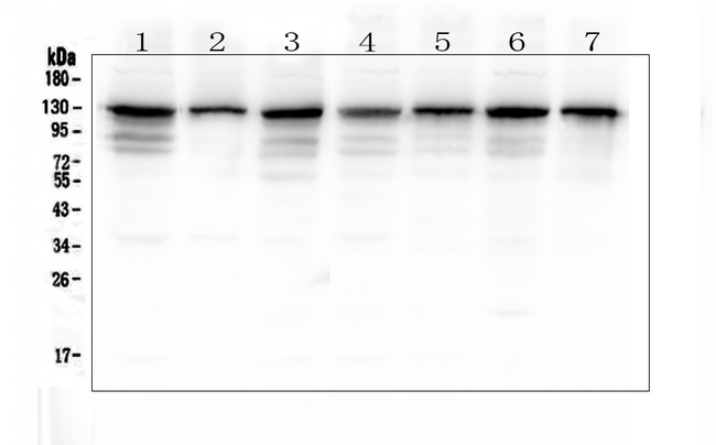 ANO1 / DOG1 / TMEM16A Antibody - Western blot analysis of TMEM16A using anti-TMEM16A antibody. Electrophoresis was performed on a 5-20% SDS-PAGE gel at 70V (Stacking gel) / 90V (Resolving gel) for 2-3 hours. The sample well of each lane was loaded with 50ug of sample under reducing conditions. Lane 1: human Hela whole cell lysate,Lane 2: human HepG2 whole cell lysate,Lane 3: human A549 whole cell lysate,Lane 4: human PANC-1 whole cell lysate,Lane 5: human SK-OV-3 whole cell lysate,Lane 6: human SGC-7901 whole cell lysate,Lane 7: human COLO-320 whole cell lysate. After Electrophoresis, proteins were transferred to a Nitrocellulose membrane at 150mA for 50-90 minutes. Blocked the membrane with 5% Non-fat Milk/ TBS for 1.5 hour at RT. The membrane was incubated with rabbit anti-TMEM16A antigen affinity purified polyclonal antibody at 0.5 µg/mL overnight at 4°C, then washed with TBS-0.1% Tween 3 times with 5 minutes each and probed with a goat anti-rabbit IgG-HRP secondary antibody at a dilution of 1:10000 for 1.5 hour at RT. The signal is developed using an Enhanced Chemiluminescent detection (ECL) kit with Tanon 5200 system. A specific band was detected for TMEM16A at approximately 130KD. The expected band size for TMEM16A is at 114KD.
