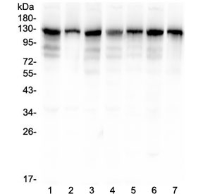 ANO1 / DOG1 / TMEM16A Antibody - Western blot testing of human 1) HeLa, 2) HepG2, 3) A549, 4) PANC-1, 5) SK-OV-3, 6) SGC-7901 and 7) COLO-320 lysate with TMEM16A antibody at 0.5ug/ml. Expected molecular weight 114~130 kDa depending on glycosylation level.