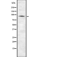 ANO1 / DOG1 / TMEM16A Antibody - Western blot analysis of ANO1 using Jurkat whole lysates.