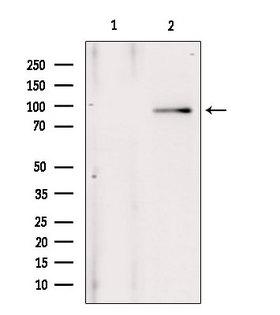 ANO1 / DOG1 / TMEM16A Antibody - Western blot analysis of extracts of 293 cells using ANO1 antibody. Lane 1 was treated with the blocking peptide.