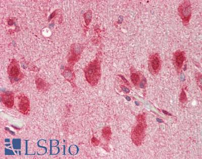 ANO10 / TMEM16K Antibody - Human Brain, Cortex: Formalin-Fixed, Paraffin-Embedded (FFPE).  This image was taken for the unconjugated form of this product. Other forms have not been tested.