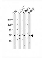 ANO10 / TMEM16K Antibody - All lanes: Anti-ANO10 Antibody (C-Term) at 1:1000-2000 dilution. Lane 1: Y79 whole cell lysate. Lane 2: 293T/17 whole cell lysate. Lane 3: human heart lysate. Lane 4: mouse brain lysate Lysates/proteins at 20 ug per lane. Secondary Goat Anti-Rabbit IgG, (H+L), Peroxidase conjugated at 1:10000 dilution. Predicted band size: 76 kDa. Blocking/Dilution buffer: 5% NFDM/TBST.