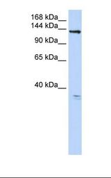 ANO3 / TMEM16C Antibody - 293T cell lysate. Antibody concentration: 1.0 ug/ml. Gel concentration: 6-18%.  This image was taken for the unconjugated form of this product. Other forms have not been tested.