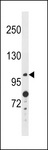 ANO4 Antibody - ANO4 Antibody western blot of A2058 cell line lysates (35 ug/lane). The ANO4 antibody detected the ANO4 protein (arrow).