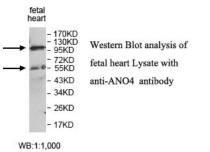 ANO4 Antibody - Western blot of ANO4 antibody