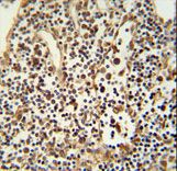ANO5 / Anoctamin 5 Antibody - ANO5 Antibody immunohistochemistry of formalin-fixed and paraffin-embedded human lymph tissue followed by peroxidase-conjugated secondary antibody and DAB staining.