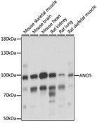 ANO5 / Anoctamin 5 Antibody - Western blot analysis of extracts of various cell lines, using ANO5 antibody at 1:1000 dilution. The secondary antibody used was an HRP Goat Anti-Rabbit IgG (H+L) at 1:10000 dilution. Lysates were loaded 25ug per lane and 3% nonfat dry milk in TBST was used for blocking. An ECL Kit was used for detection and the exposure time was 5s.