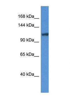 ANO6 Antibody - ANO6 antibody Western blot of Mouse Liver lysate. Antibody concentration 1 ug/ml. This image was taken for the unconjugated form of this product. Other forms have not been tested.