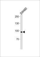 ANO6 Antibody - ANO6 Antibody western blot of SW480 cell line lysates (35 ug/lane). The ANO6 antibody detected the ANO6 protein (arrow).