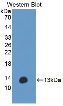 ANO6 Antibody - Western blot of ANO6 antibody.