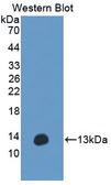 ANO6 Antibody - Western blot of ANO6 antibody.