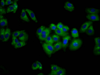 ANO6 Antibody - Immunofluorescence staining of HepG2 cells diluted at 1:100, counter-stained with DAPI. The cells were fixed in 4% formaldehyde, permeabilized using 0.2% Triton X-100 and blocked in 10% normal Goat Serum. The cells were then incubated with the antibody overnight at 4°C.The Secondary antibody was Alexa Fluor 488-congugated AffiniPure Goat Anti-Rabbit IgG (H+L).
