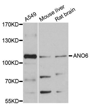 ANO6 Antibody - Western blot analysis of extracts of various cell lines, using ANO6 antibody at 1:3000 dilution. The secondary antibody used was an HRP Goat Anti-Rabbit IgG (H+L) at 1:10000 dilution. Lysates were loaded 25ug per lane and 3% nonfat dry milk in TBST was used for blocking. An ECL Kit was used for detection and the exposure time was 90s.