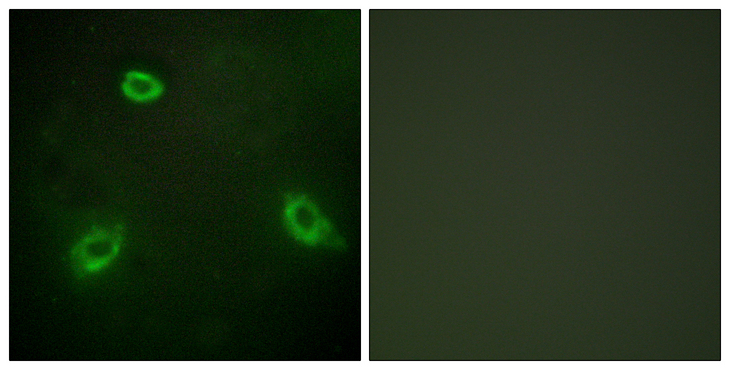 ANO7 / TMEM16G / NGEP Antibody - Immunofluorescence analysis of HepG2 cells, using TM16G Antibody. The picture on the right is blocked with the synthesized peptide.