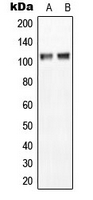 ANO7 / TMEM16G / NGEP Antibody - Western blot analysis of NGEP expression in MCF7 (A); NIH3T3 (B) whole cell lysates.