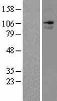ANO7 / TMEM16G / NGEP Protein - Western validation with an anti-DDK antibody * L: Control HEK293 lysate R: Over-expression lysate