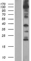 ANO8 / TMEM16H Protein - Western validation with an anti-DDK antibody * L: Control HEK293 lysate R: Over-expression lysate