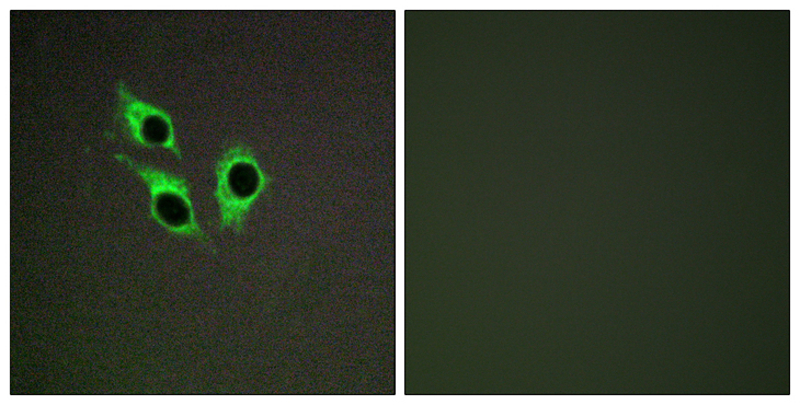 ANO9 / TMEM16J Antibody - Immunofluorescence analysis of HepG2 cells, using TM16J Antibody. The picture on the right is blocked with the synthesized peptide.