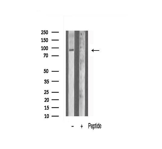 ANO9 / TMEM16J Antibody - Western blot analysis of TM16J antibody expression in HeLa cells lysates. The lane on the right is treated with the antigen-specific peptide.