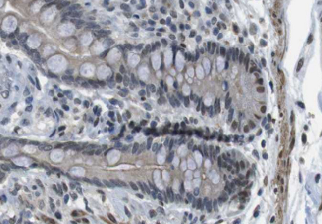 ANO9 / TMEM16J Antibody - 1:100 staining human colon tissue by IHC-P. The tissue was formaldehyde fixed and a heat mediated antigen retrieval step in citrate buffer was performed. The tissue was then blocked and incubated with the antibody for 1.5 hours at 22°C. An HRP conjugated goat anti-rabbit antibody was used as the secondary.