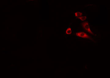 ANO9 / TMEM16J Antibody - Staining MCF-7 cells by IF/ICC. The samples were fixed with PFA and permeabilized in 0.1% Triton X-100, then blocked in 10% serum for 45 min at 25°C. The primary antibody was diluted at 1:200 and incubated with the sample for 1 hour at 37°C. An Alexa Fluor 594 conjugated goat anti-rabbit IgG (H+L) antibody, diluted at 1/600, was used as secondary antibody.