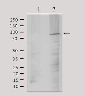ANO9 / TMEM16J Antibody - Western blot analysis of extracts of mouse brain tissue using TM16J antibody. Lane 1 was treated with the antigen-specific peptide.