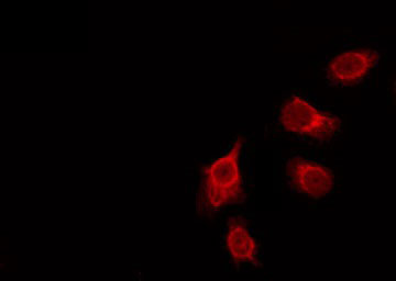 Anopheles gambiae GPROPDR Antibody - Staining HeLa cells by IF/ICC. The samples were fixed with PFA and permeabilized in 0.1% Triton X-100, then blocked in 10% serum for 45 min at 25°C. The primary antibody was diluted at 1:200 and incubated with the sample for 1 hour at 37°C. An Alexa Fluor 594 conjugated goat anti-rabbit IgG (H+L) Ab, diluted at 1/600, was used as the secondary antibody.