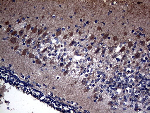 ANOS1 / Anosmin Antibody - Immunohistochemical staining of paraffin-embedded Human embryonic cerebellum within the normal limits using anti-KAL1 mouse monoclonal antibody. (Heat-induced epitope retrieval by 1mM EDTA in 10mM Tris buffer. (pH8.5) at 120 oC for 3 min. (1:500)