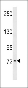 ANOS1 / Anosmin Antibody - KAL1 Antibody western blot of MDA-MB453 cell line lysates (35 ug/lane). The KAL1 antibody detected the KAL1 protein (arrow).