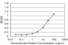 ANOS1 / Anosmin Antibody - Detection limit for recombinant GST tagged KAL1 is approximately 1 ng/ml as a capture antibody.