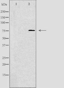 ANOS1 / Anosmin Antibody - Western blot analysis of extracts of HuvEc cells using KAL1 antibody. The lane on the left is treated with the antigen-specific peptide.